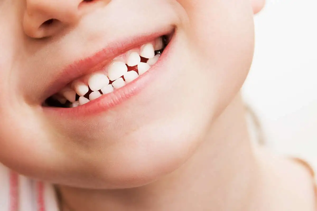 دندان های شیری و دائمی چه تفاوت هایی دارند؟