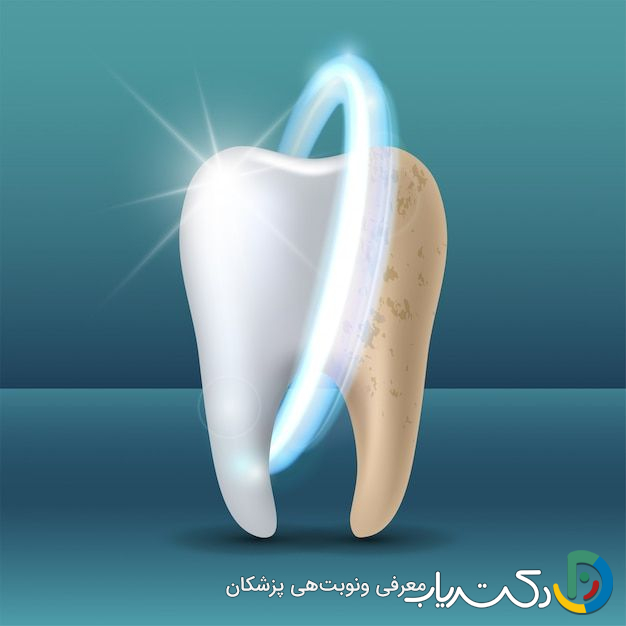 معایب بلیچینگ دندان چیست؟راهنمای جامع برای سفید کردن ایمن دندانها