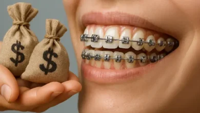 چه عواملی بر هزینه درمان ارتودنسی تأثیر می گذارند؟
