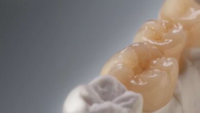 چه عواملی بر طول عمر ترمیم دندان تأثیر می گذارند؟