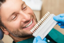 چه عواملی بر قیمت کامپوزیت دندان تأثیر می گذارند؟