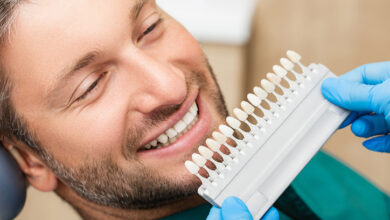 چه عواملی بر قیمت کامپوزیت دندان تأثیر می گذارند؟