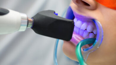 اگر مواد بلیچینگ دندان قورت داده شود چه اتفاقی می افتد؟