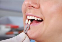 چه مشکلاتی ممکن است پس از نصب روکش دندان پیش آید؟