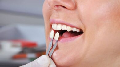 چه مشکلاتی ممکن است پس از نصب روکش دندان پیش آید؟
