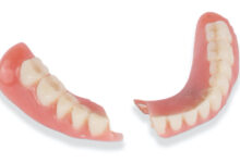 چه مشکلاتی ممکن است پس از نصب دندان مصنوعی پیش آید؟