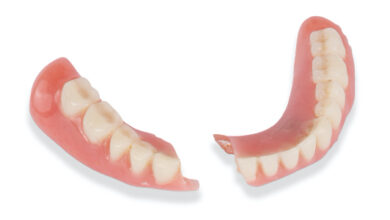 چه مشکلاتی ممکن است پس از نصب دندان مصنوعی پیش آید؟