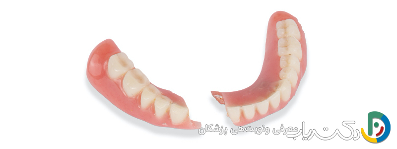 چه مشکلاتی ممکن است پس از نصب دندان مصنوعی پیش آید؟