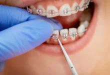 چه مشکلاتی ممکن است در طول درمان ارتودنسی پیش آید؟