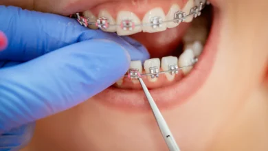 چه مشکلاتی ممکن است در طول درمان ارتودنسی پیش آید؟