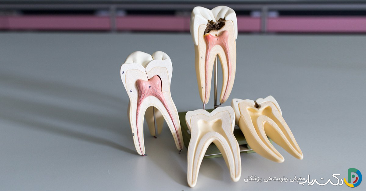 چه کارهایی نباید بعد از عصب کشی دندان انجام دهیم؟