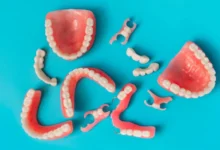 چه نوع دندان مصنوعی برای افراد مختلف مناسب تر است؟