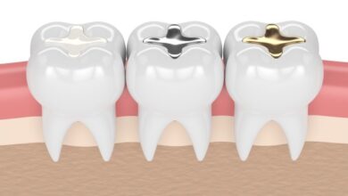 چه نوع مواد پرکننده برای ترمیم دندان استفاده می شود؟