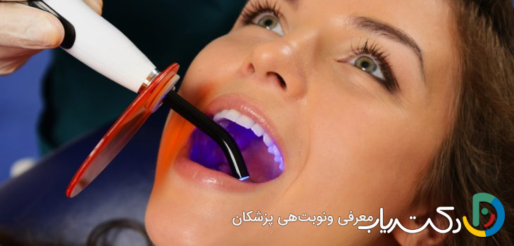 چه زمانی باید برای کامپوزیت دندان اقدام کنیم؟