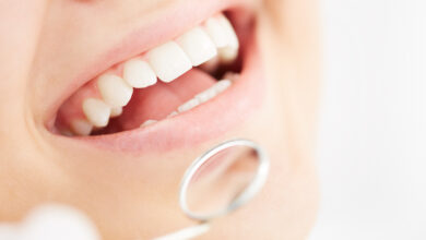 چه زمانی باید برای بلیچینگ دندان اقدام کرد؟