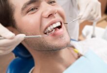 چه زمانی باید برای ترمیم دندان اقدام کرد؟