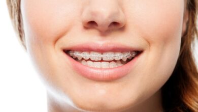 چه زمانی باید برای ارتودنسی اقدام کرد؟