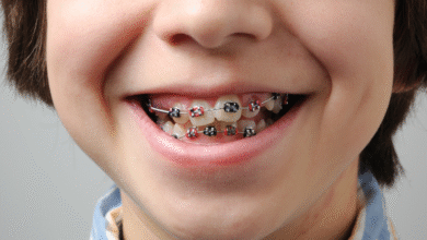 چرا ارتودنسی بهترین روش برای اصلاح دندان های کج است؟