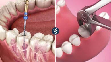 چرا عصب کشی دندان بهتر از کشیدن دندان است؟