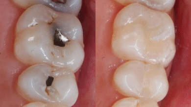 چه تفاوتی بین ترمیم دندان و سایر درمان ها وجود دارد؟