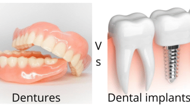 چه تفاوتی بین دندان مصنوعی و ایمپلنت دندان وجود دارد؟