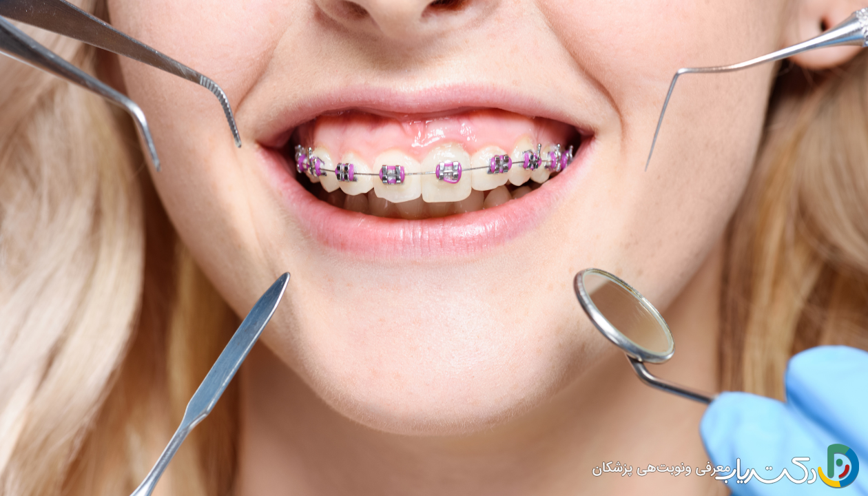 چه تفاوت هایی بین ارتودنسی و دیگر درمان های دندان وجود دارد؟