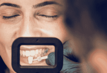 آیا بعد از انجام کامپوزیت دندان باید مراقبت خاصی انجام دهیم؟