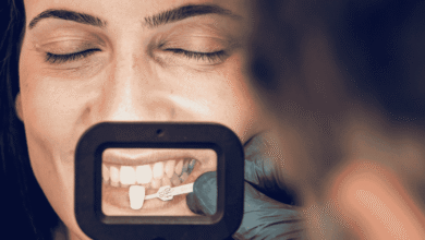 آیا بعد از انجام کامپوزیت دندان باید مراقبت خاصی انجام دهیم؟