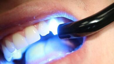 آیا کامپوزیت دندان درد دارد؟