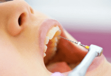 آیا عصب دندان کشی درد دارد؟