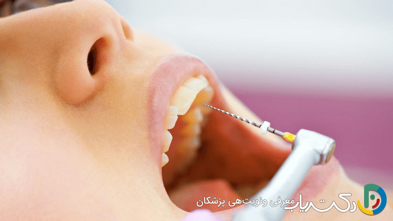 آیا عصب دندان کشی درد دارد؟