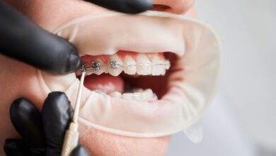 چگونه درمان ارتودنسی در افراد مسن با افراد جوان تفاوت دارد؟