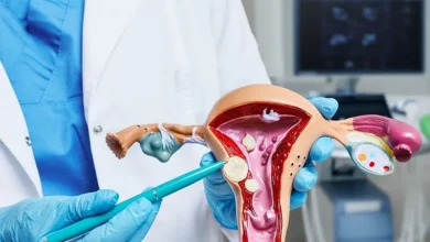 بهترین روش عمل فیبروم رحم کدام است؟ (باز، لاپاراسکوپی، هیستروسکوپی)