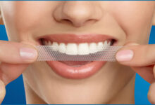 آیا نوارهای سفید کننده دندان موثر هستند؟