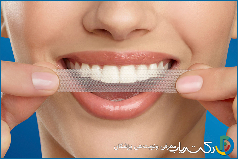 آیا نوارهای سفید کننده دندان موثر هستند؟