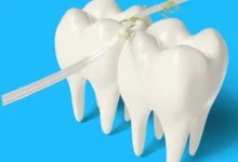 آیا می توان روی دندان پر شده نخ دندان کشید؟