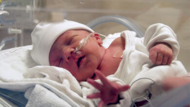 آیا سرکلاژ از زایمان زودرس صد در صد جلوگیری میکند؟