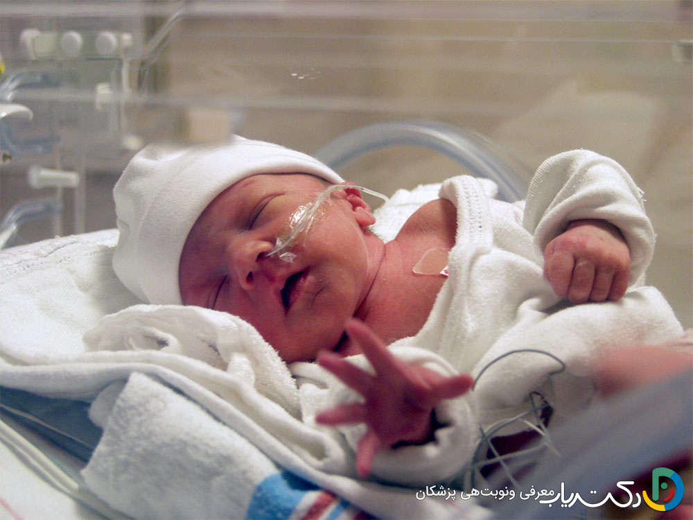 آیا سرکلاژ از زایمان زودرس صد در صد جلوگیری میکند؟