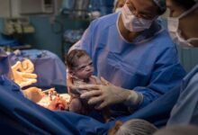 آیا سزارین درد دارد؟