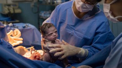 آیا سزارین درد دارد؟