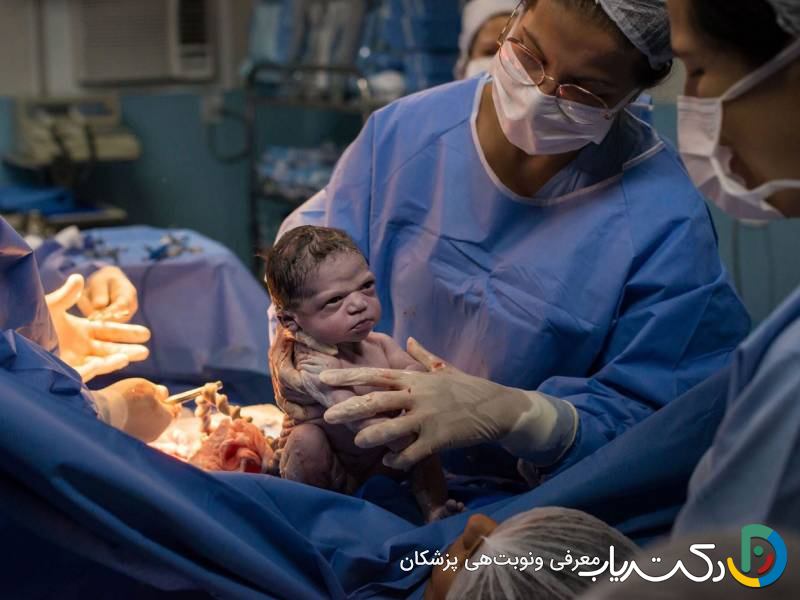 آیا سزارین درد دارد؟