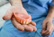 درمان زخم لثه ناشی از دندان مصنوعی