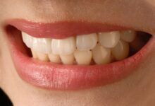 تاثیر دیابت بر روی سلامت دهان و دندان چگونه است ؟