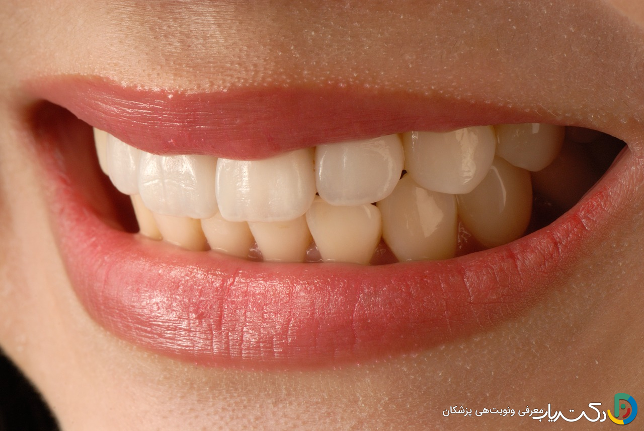 تاثیر دیابت بر روی سلامت دهان و دندان چگونه است ؟