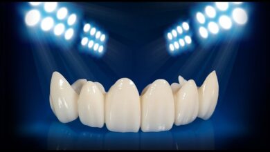 کامپوزیت دندان آمریکایی بهتر است یا ژاپنی؟