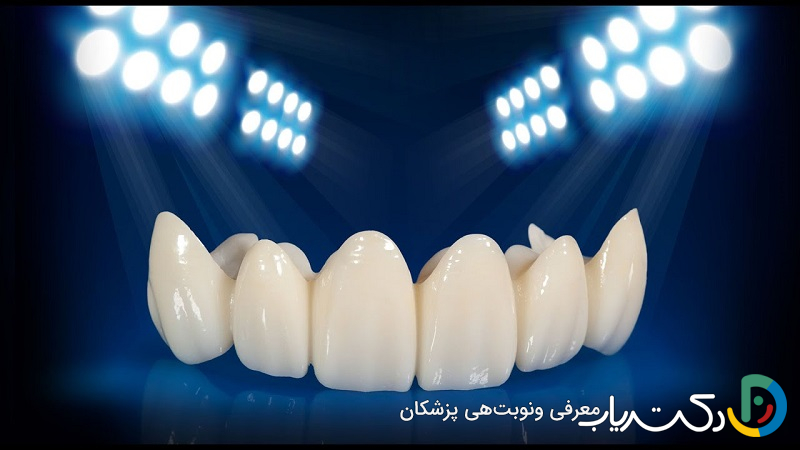 کامپوزیت دندان آمریکایی بهتر است یا ژاپنی؟