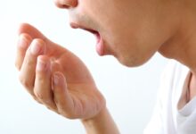 آیا بوی بد دهان بعد از ایمپلنت طبیعی است؟