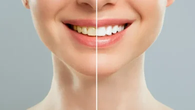 برای سفید کردن، بلیچینگ بهتر است یا جرمگیری؟