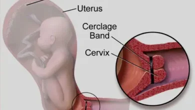 آیا جراحی سرکلاژ دردناک است؟