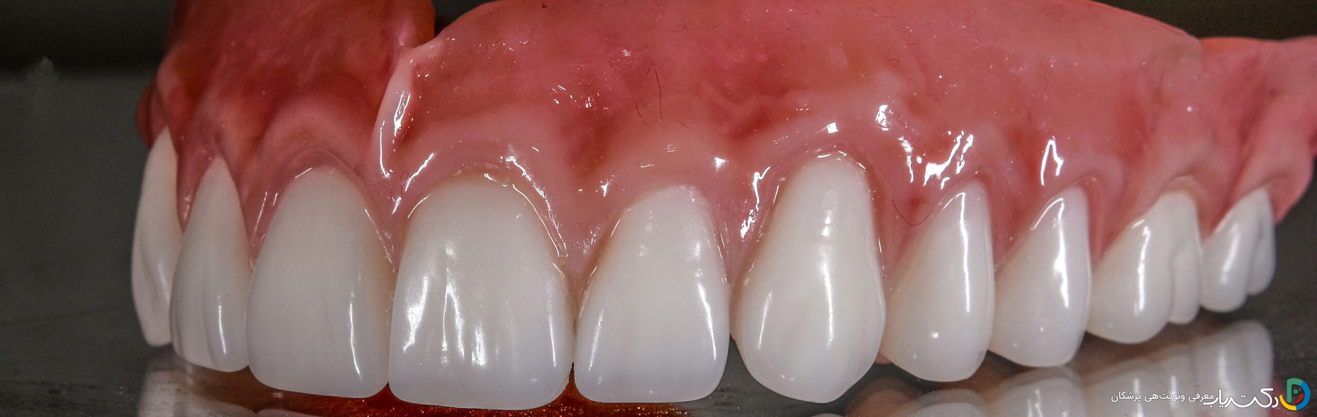 آیا کامپوزیت قابل برداشتن ریموو است؟